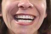 Tempo per risolvere le difficoltà dei denti. Dental care.
